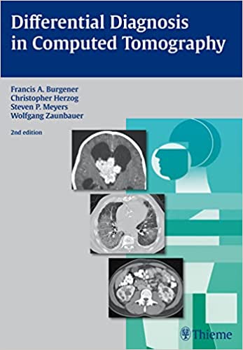 Differential Diagnosis in Computed Tomography 2nd Edition by Francis A. Burgener