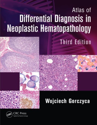 Atlas of Differential Diagnosis in Neoplastic Hematopathology 3rd Edition by Wojciech Gorczyca