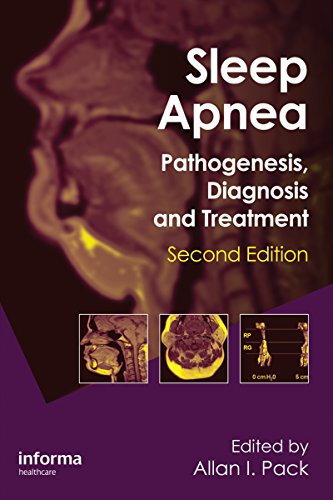 Sleep Apnea Pathogenesis, Diagnosis and Treatment 2nd Edition by Allan I. Pack