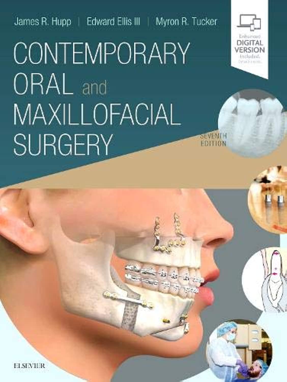 Contemporary Oral and Maxillofacial Surgery 7th Edition