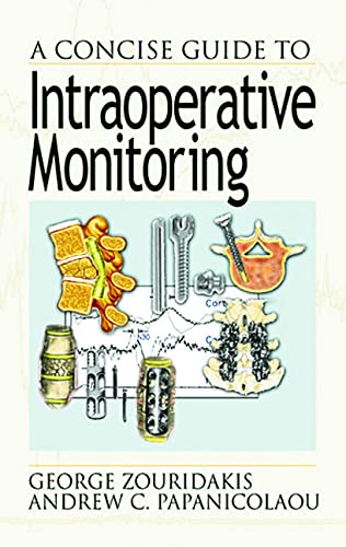 A Concise Guide to Intraoperative Monitoring