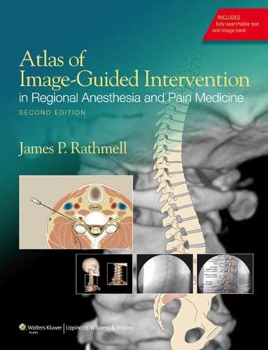 Atlas of Image-Guided Intervention in Regional Anesthesia and Pain Medicine - 2nd Edition