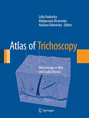 Atlas of Trichoscopy: Dermoscopy in Hair and Scalp Disease - 1st Edition