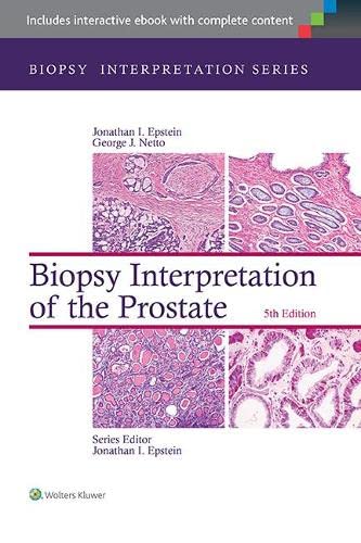 Biopsy Interpretation of the Prostate - 5th Edition