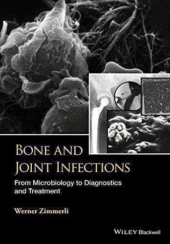 Bone And Joint Infections From Microbiology To Diagnostics And Treatment