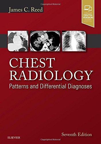 Chest Radiology Patterns And Differential Diagnoses 7Th Edition