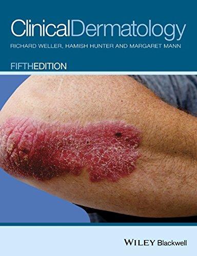 Clinical Dermatology 5Th Edition