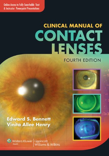 Clinical Manual of Contact Lenses - 4th Edition