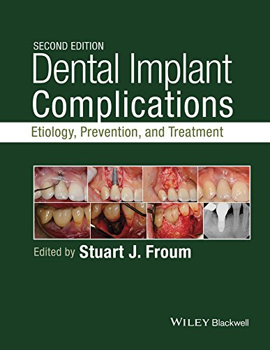 Dental Implant Complications: Etiology, Prevention, and Treatment - 2nd Edition