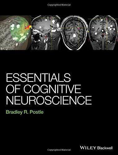 Essentials Of Cognitive Neuroscience