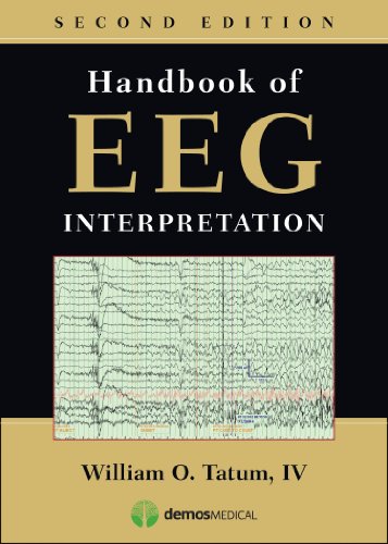 Handbook of EEG Interpretation - 2nd Edition