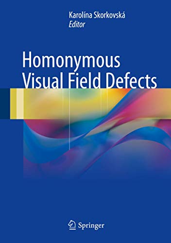 Homonymous Visual Field Defects – GIFTSQUALITY LTD