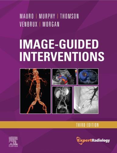 Image Guided Interventions Expert Radiology Series 3Rd Edition