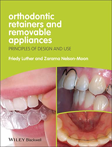 Orthodontic Retainers and Removable Appliances: Principles of Design and Use - 1st Edition