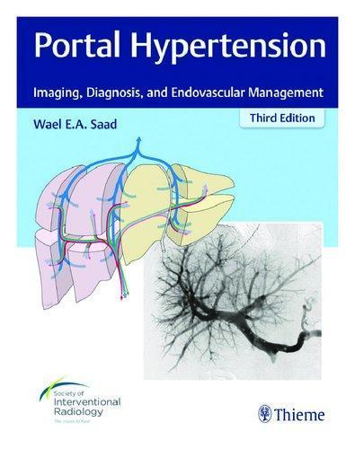 Portal Hypertension Imaging Diagnosis And Endovascular Management 3Rd Edition