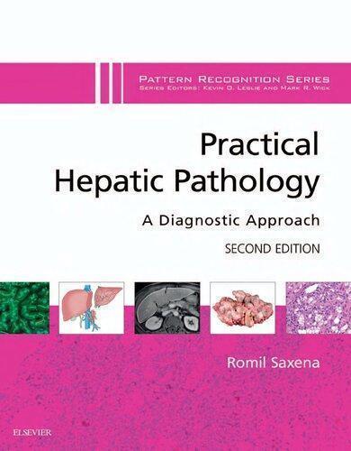 Practical Hepatic Pathology A Diagnostic Approach 2Nd Edition