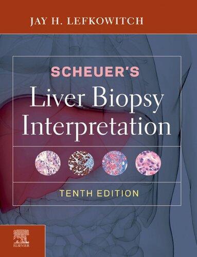 Scheuers Liver Biopsy Interpretation 10Th Edition