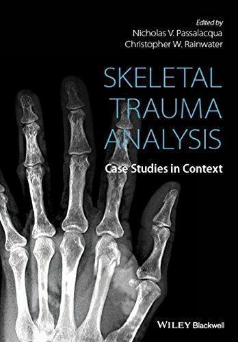 Skeletal Trauma Analysis Case Studies In Context