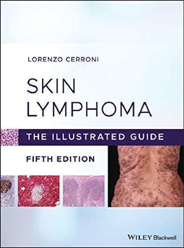 Skin Lymphoma The Illustrated Guide 5Th Edition