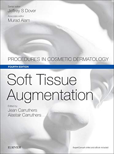 Soft tissue augmentation - 4th Edition