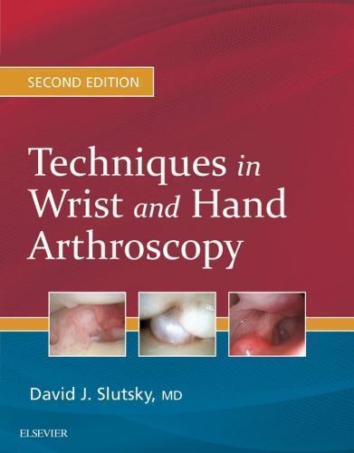 Techniques In Wrist And Hand Arthroscopy 2Nd Edition