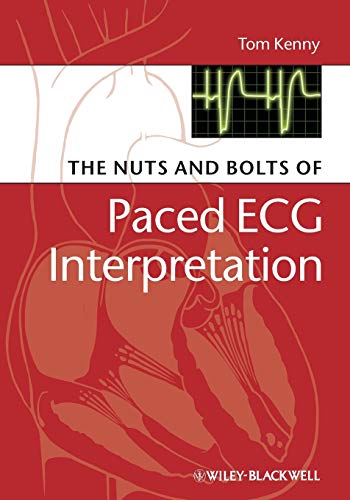 The Nuts and bolts of Paced ECG Interpretation (Nuts and Bolts Series) - 1st Edition