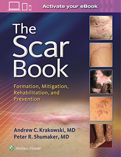 The Scar Book: Formation, Mitigation, Rehabilitation and Prevention 1st Edition