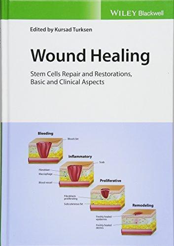 Wound Healing Stem Cells Repair And Restorations Basic And Clinical Aspects